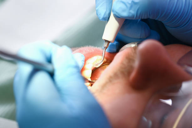 Best Weekend Emergency Dentist in Ridgemark, CA
